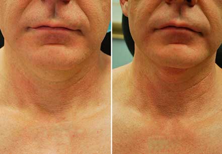 BodyFX mini фото