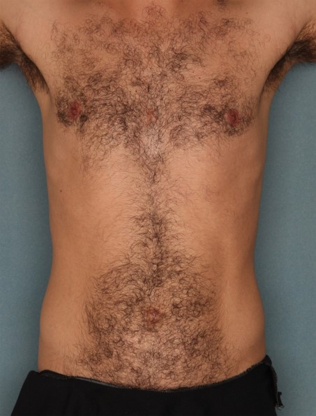 Motif Vantage фото