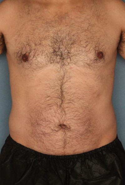 Motif Vantage фото