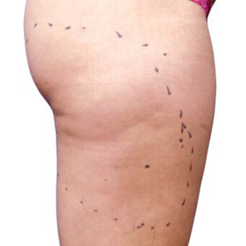 Venus Versa Фото до та після