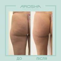 Detoxy програма AROSHA бандажне обгортання