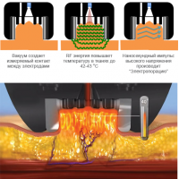 Насадка BodyFX до платформи Trinon для корекції контурів тіла від Inmode Invasix