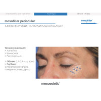 Філер для корекції зони навколо очей та зморшок Mesofiller Periocular Mesoestetic