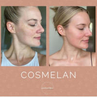 COSMELAN - PACK / ПРОФЕСІЙНА ПРОГРАМА 