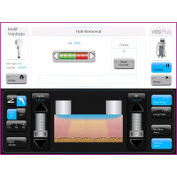 Аплікатор Motif Vantage для лазерної епіляції від Candela