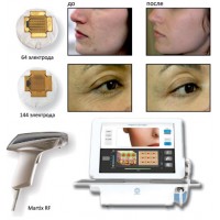 Аплікатор Matrix RF для фракційного шліфування від Candela Аплікатор Matrix RF для фракційного шліфування від Candela
