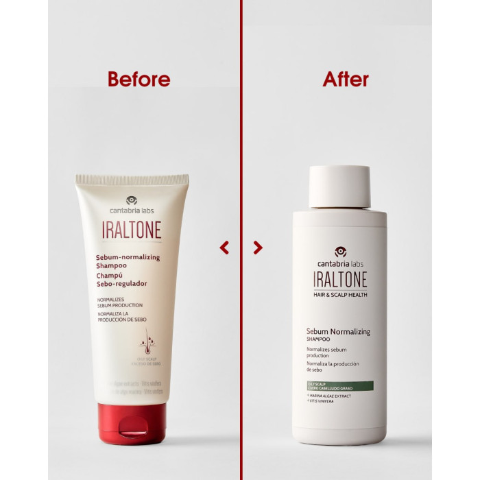 Шампунь для жирної шкіри голови Cantabria Labs Iraltone Sebum-normalizing Shampoo