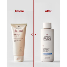 Іралтон шампунь проти лупи та себорейного дерматиту / IRALTONE CHAMPU DS