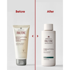 IRALTONE EXFOLIATING & PURIFYING SHAMPOO Відлущуючий та очищуючий шампунь